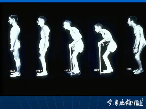 让李宇春感到“石化”般疼痛的病，“天一甬宁保”也能保障